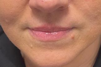 Before image