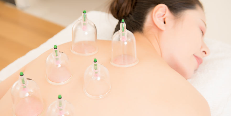 Cupping Therapy